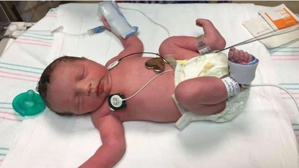 Urodziła się dwa razy obalając mit o potrzebie aborcji.