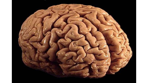 Najdokładniejsza mapa mózgu