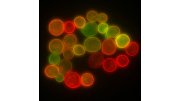 Mikroskopia fluorescencyjna na Nobla